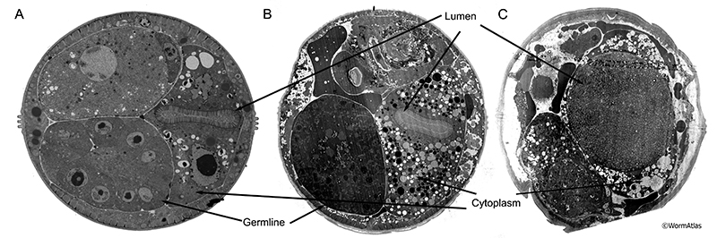 AIntFIG 2: Transmission electron micrographs (TEMs) of young and old C. elegans intestine, seen in cross-section.